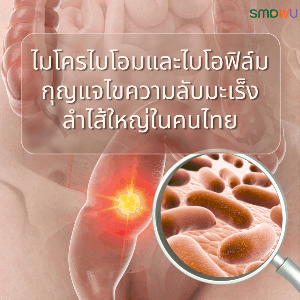 ไมโครไบโอมและไบโอฟิล์ม กุญแจไขความลับมะเร็งลำไส้ใหญ่ในคนไทย
